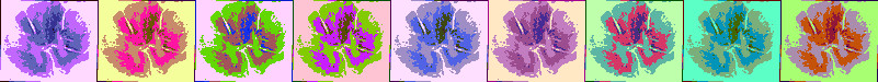 Neuropathologische Präparate