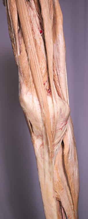 P1-Knie-3-IMG_7598