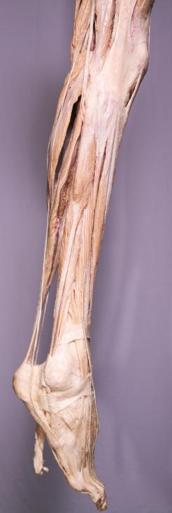 P1-Unterschenkel-&-Fuß-2-IMG_7570