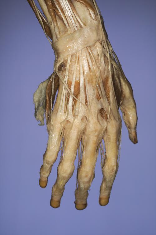 P9-Hand-4-IMG_7941