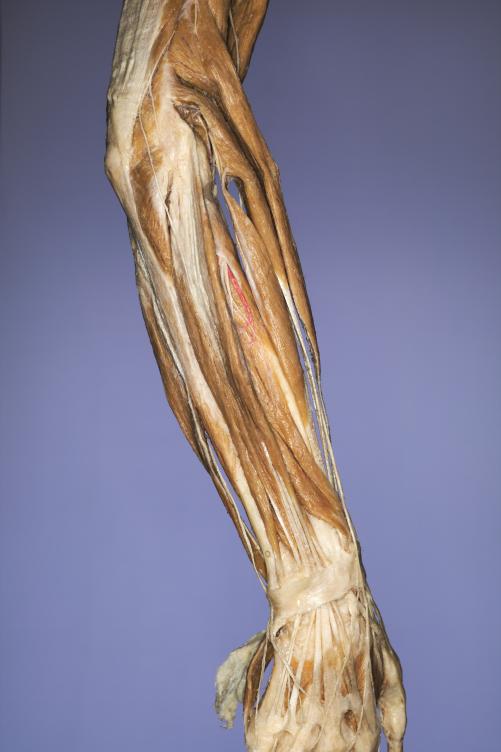 P9-Unterarm-&-Hand-4-IMG_7940