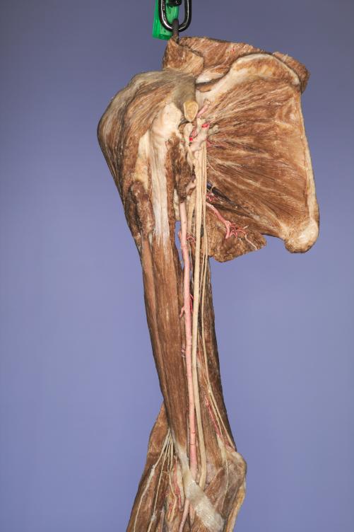 P11-Schulter-&-Oberarm-2-IMG_7986