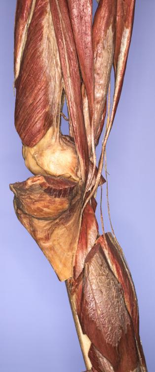 P13-Knie-2-IMG_8326