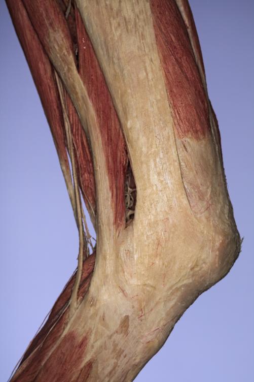 P15-Knie-4-IMG_8250