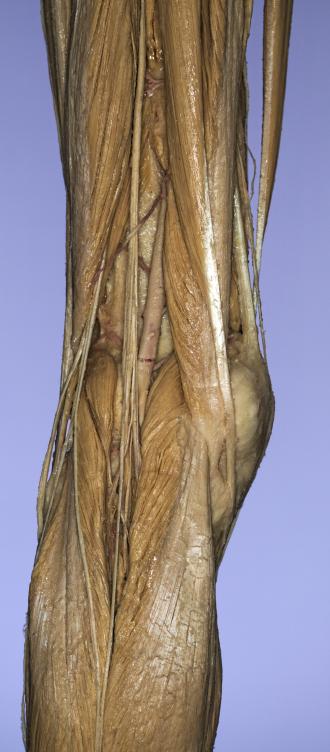 P16-Knie-3-IMG_8196