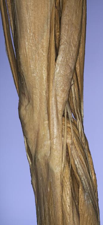P16-Knie-4-IMG_8206