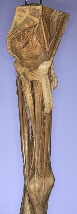 P20-Hüfte-&-Oberschenkel-2-IMG_8031