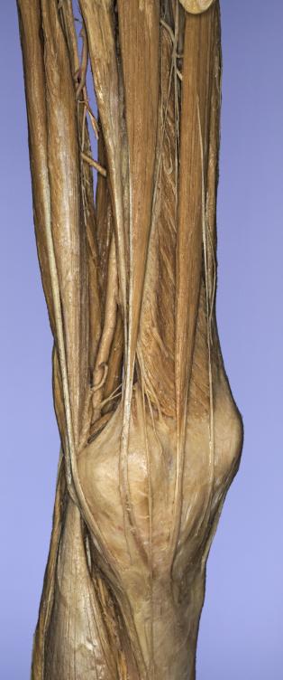 P20-Knie-1-IMG_8032