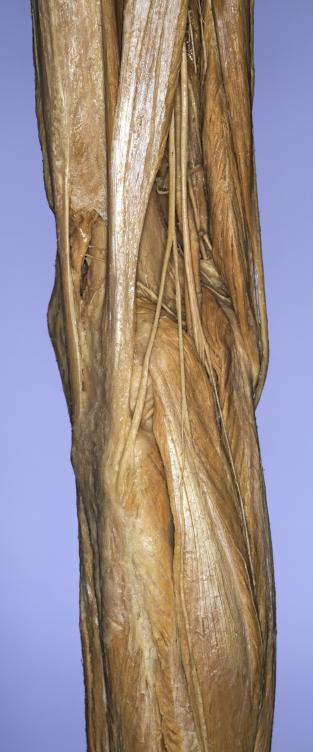 P20-Knie-3-IMG_8055