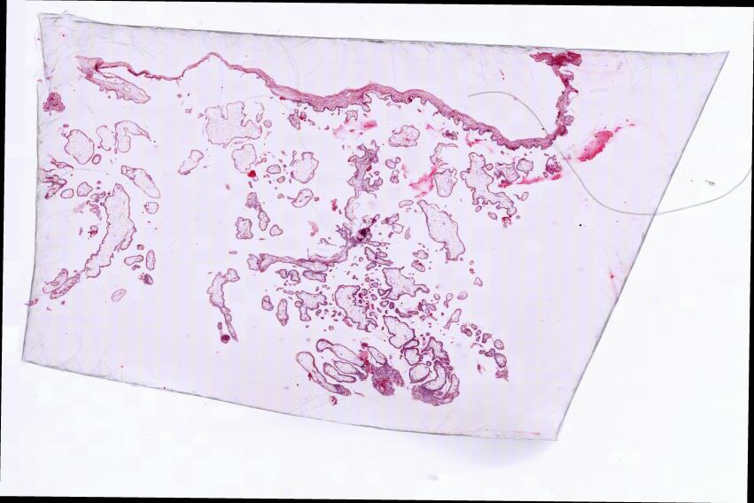 Vorschaubild fehlt :-(